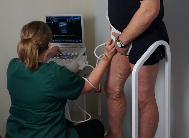 pregled vena prije laserske koagulacije na proširene vene